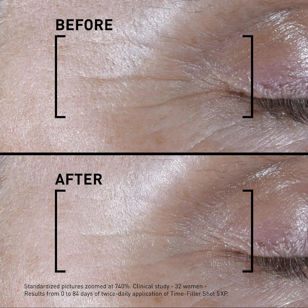 Filorga Time-Filler Shot 5XP Concentrated Serum - Visible Expression Lines Correction 15ml (Συμπυκνωμένο Serum - Ορατή Βελτίωση των Γραμμών Έκφρασης) Filorga Time-Filler Shot 5XP Concentrated Serum - Visible Expression Lines Correction 15ml (Συμπυκνωμένο Serum - Ορατή Βελτίωση των Γραμμών Έκφρασης)
