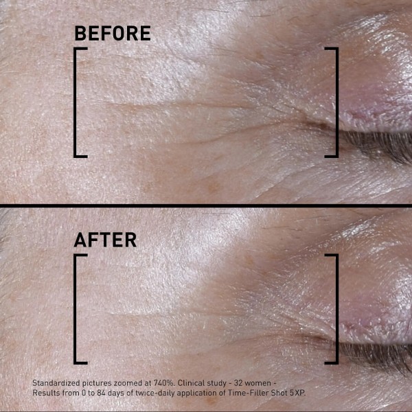 Filorga Time-Filler Shot 5XP Concentrated Serum - Visible Expression Lines Correction 15ml (Συμπυκνωμένο Serum - Ορατή Βελτίωση των Γραμμών Έκφρασης)