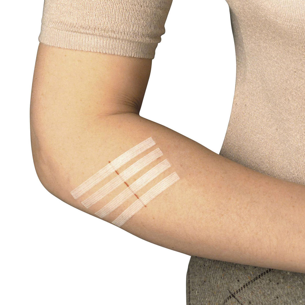 Master Aid Sterigrap Wound Closure Strip (3mm x 75mm) 10strips (Ταινία σύγκλησης Τραυμάτων) Master Aid Sterigrap Wound Closure Strip (3mm x 75mm) 10strips (Ταινία σύγκλησης Τραυμάτων)