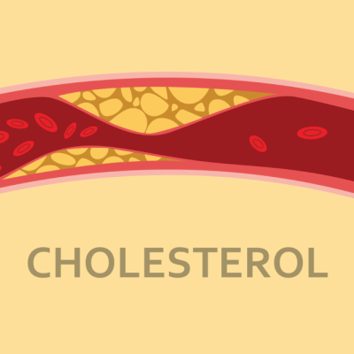 Η Χοληστερίνη & η αντιμετώπιση της!